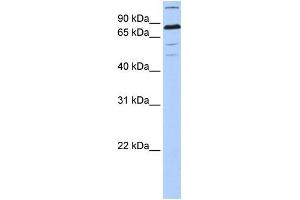 Human 721_B; WB Suggested Anti-ZNF700 Antibody Titration: 0. (ZNF700 Antikörper  (C-Term))