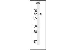 Western Blotting (WB) image for anti-Interferon Regulatory Factor 2 Binding Protein 2 (IRF2BP2) (AA 344-374), (Middle Region) antibody (ABIN952948)