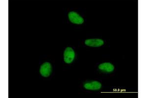 Immunofluorescence of purified MaxPab antibody to ZNF496 on HeLa cell. (ZNF496 Antikörper  (AA 1-587))
