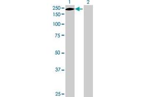 Western Blotting (WB) image for ERCC5 293T Cell Transient Overexpression Lysate(Denatured) (ABIN1331735)