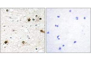 Immunohistochemistry analysis of paraffin-embedded human brain tissue, using NAB2 Antibody.