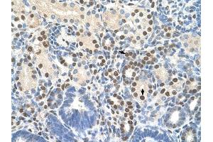 ZNF326 antibody was used for immunohistochemistry at a concentration of 4-8 ug/ml to stain Epithelial cells of renal tubule (arrows) in Human Kidney. (ZNF326 Antikörper  (C-Term))
