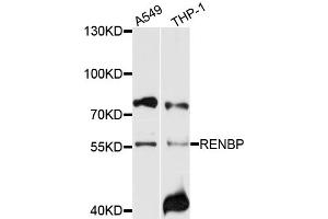 Western blot analysis of extracts of various cell lines, using RENBP antibody (ABIN4904991) at 1:1000 dilution.