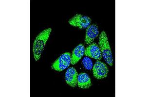 Confocal immunofluorescent analysis of WT1 Antibody (Center ) (ABIN655904 and ABIN2845304) with MCF-7 cell followed by Alexa Fluor® 488-conjugated goat anti-rabbit lgG (green). (WT1 Antikörper  (AA 346-375))