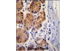 CTNB1 Antibody (C-term) (ABIN655178 and ABIN2844795) immunohistochemistry analysis in formalin fixed and paraffin embedded human stomach tissue followed by peroxidase conjugation of the secondary antibody and DAB staining. (CTNNB1 Antikörper  (C-Term))