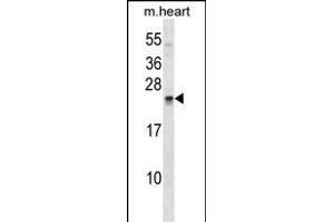 SOSTDC1 Antibody (C-term) (ABIN1536776 and ABIN2849017) western blot analysis in mouse heart tissue lysates (35 μg/lane). (SOSTDC1 Antikörper  (C-Term))