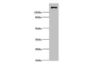 Western blot All lanes: EIF2AK4 antibody at 2 μg/mL + Mouse lung tissue Secondary Goat polyclonal to rabbit IgG at 1/10000 dilution Predicted band size: 187, 184, 70 kDa Observed band size: 187 kDa (GCN2 Antikörper  (AA 1-300))