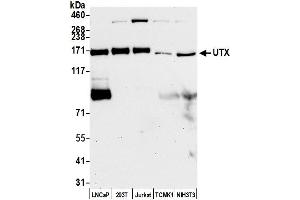 Western Blotting (WB) image for anti-Lysine (K)-Specific Demethylase 6A (KDM6A) (AA 700-750) antibody (ABIN7449926)