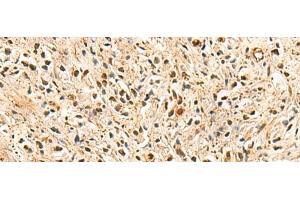 Immunohistochemistry (Paraffin-embedded Sections) (IHC (p)) image for anti-Proteasome Subunit Alpha Type 3 (PSMA3) antibody (ABIN7246538)