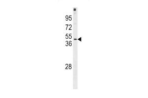 FRA10AC1 Antibody (C-term) (ABIN1881352 and ABIN2843283) western blot analysis in NCI- cell line lysates (35 μg/lane).