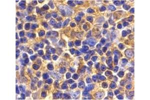 Immunohistochemistry of UBC13 in mouse thymus tissue with UBC13 antibody at 2 μg/ml.