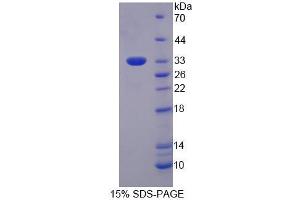 SDS-PAGE analysis of Human EIF3M Protein. (Eukaryotic Translation Initiation Factor 3, Subunit M (EIF3M) Protein)
