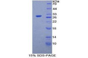 SDS-PAGE (SDS) image for Calcium Independent Phospholipase A2 (PNPLA2) (AA 481-702) protein (His tag) (ABIN2126298) (PNPLA2 Protein (AA 481-702) (His tag))