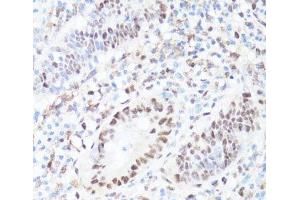 Immunohistochemistry (Paraffin-embedded Sections) (IHC (p)) image for anti-Myc Proto-Oncogene protein (MYC) (pSer62) antibody (ABIN7265076)