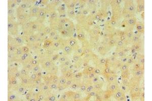 Immunohistochemistry (IHC) image for anti-Cytochrome P450, Family 4, Subfamily F, Polypeptide 12 (CYP4F12) (AA 265-524) antibody (ABIN7149272)