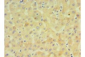 Immunohistochemistry of paraffin-embedded human liver tissue using ABIN7149272 at dilution of 1:100 (CYP4F12 Antikörper  (AA 265-524))