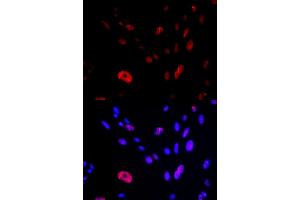 Immunofluorescence (IF) image for anti-HUS1 Checkpoint Homolog (S. Pombe) (HUS1) antibody (ABIN1876595) (HUS1 Antikörper)