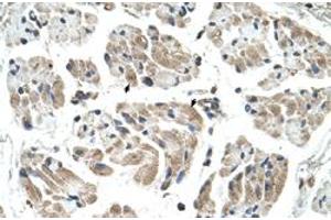 Immunohistochemical staining (Formalin-fixed paraffin-embedded sections) of human muscle with CHST1 polyclonal antibody  at 4-8 ug/mL working concentration. (CHST1 Antikörper  (N-Term))