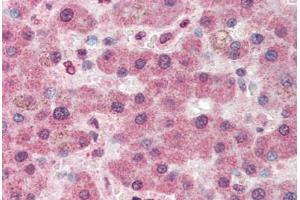 Human Liver (formalin-fixed, paraffin-embedded) stained with PC antibody ABIN337183 at 5 ug/ml followed by biotinylated anti-goat IgG secondary antibody ABIN481715, alkaline phosphatase-streptavidin and chromogen. (PC Antikörper  (AA 886-899))