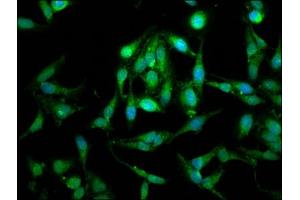 Immunofluorescence staining of Hela cells with ABIN7159933 at 1:100, counter-stained with DAPI. (LETM1 Antikörper  (AA 443-543))