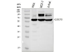 anti-Parafibromin (CDC73) (AA 119-520) antibody