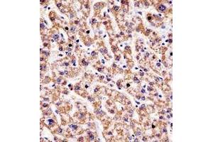 Immunohistochemistry analysis in formalin fixed and paraffin embedded human liver tissue reacted with HYAL1 / Hyaluronidase-1 Antibody (C-term) followed by peroxidase conjugation of the secondary antibody and DAB staining. (HYAL1 Antikörper  (C-Term))