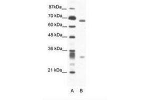 Image no. 1 for anti-Set1/Ash2 Histone Methyltransferase Complex Subunit ASH2 (ASH2L) (AA 54-103) antibody (ABIN202839)
