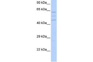 Western Blotting (WB) image for anti-Vacuolar Protein Sorting 37 Homolog A (VPS37A) antibody (ABIN2459607) (VPS37A Antikörper)