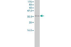 PRKRA monoclonal antibody (M01), clone 1B9-1A7. (PRKRA Antikörper  (AA 1-313))