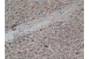 IHC-P analysis of Human Liver Tissue, with DAB staining. (APAF1 Antikörper  (AA 31-350))