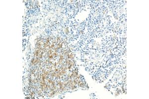 Immunohistochemistry (IHC) image for anti-CD70 Molecule (CD70) (AA 50-193) antibody (ABIN7795664)