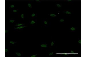 Immunofluorescence of monoclonal antibody to EGR1 on HeLa cell. (EGR1 Antikörper  (AA 211-320))