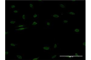 Immunofluorescence of monoclonal antibody to EGR1 on HeLa cell.