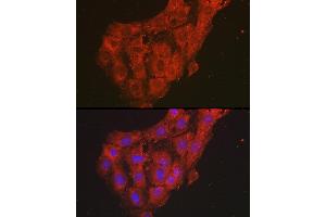 Immunofluorescence analysis of C6 cells using GRO alpha Rabbit pAb (ABIN6130150, ABIN6139267, ABIN6139268 and ABIN6221487) at dilution of 1:100 (40x lens). (CXCL1 Antikörper  (AA 1-107))