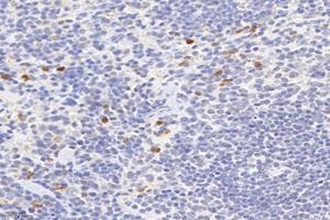 Immunohistochemistry analysis of paraffin-embedded mouse spleen using,Factor XIIIa (ABIN7073528) at dilution of 1: 2400 (F13A1 Antikörper)