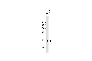 Anti-D Antibody (N-term) at 1:1000 dilution + PC-3 whole cell lysate Lysates/proteins at 20 μg per lane. (DAP Antikörper  (N-Term))