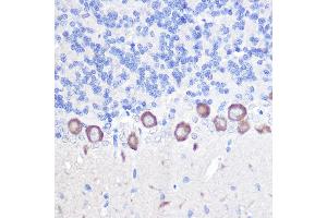 Immunohistochemistry of paraffin-embedded rat brain using PLC beta 3 (PLC beta 3 (PLCB3)) Rabbit pAb (ABIN6134972, ABIN6145749, ABIN6145750 and ABIN6214407) at dilution of 1:100 (40x lens). (PLCB3 Antikörper  (AA 1050-1150))