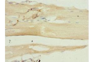 Immunohistochemistry of paraffin-embedded human skeletal muscle tissue using ABIN7169457 at dilution of 1:100 (SH2B1 Antikörper  (AA 360-520))