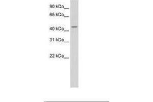 Image no. 2 for anti-tRNA Nucleotidyl Transferase, CCA-Adding, 1 (Trnt1) (AA 75-124) antibody (ABIN203116) (Trnt1 Antikörper  (AA 75-124))