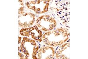 Immunohistochemical analysis of paraffin-embedded H. (CALB1 Antikörper  (AA 90-116))