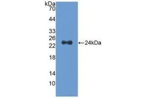 Detection of Recombinant Slit2, Human using Polyclonal Antibody to Slit Homolog 2 (Slit2) (SLIT2 Antikörper  (AA 1160-1333))
