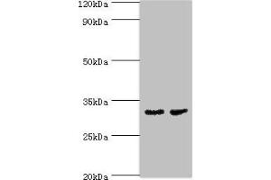 Western blot All lanes: CA8 antibody at 4 μg/mL Lane 1: Mouse skeletal muscle tissue Lane 2: Mouse liver tissue Secondary Goat polyclonal to rabbit IgG at 1/10000 dilution Predicted band size: 33 kDa Observed band size 33 kDa (CA8 Antikörper  (AA 1-290))