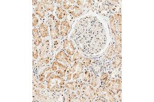 Immunohistochemical analysis of paraffin-embedded Human kidney tissue using (ABIN6243675 and ABIN6577401) performed on the Leica® BOND RXm. (GLI2 Antikörper  (C-Term))
