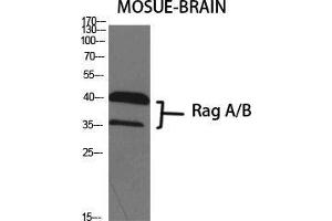Western Blot (WB) analysis of specific cells using Rag A/B Polyclonal Antibody. (RagA/B (C-Term) Antikörper)