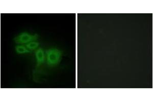 Immunofluorescence analysis of HepG2 cells, using SLK Antibody. (SLK Antikörper  (AA 1151-1200))