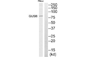 Western blot analysis of extracts from HeLa cells, using GUSB antibody. (Glucuronidase beta Antikörper)