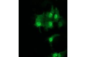 Image no. 3 for anti-Ubiquitin-Conjugating Enzyme E2S (UBE2S) antibody (ABIN1501643) (UBE2S Antikörper)