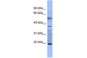 WB Suggested Anti-MYL3 Antibody Titration:  0. (MYL3/CMLC1 Antikörper  (N-Term))