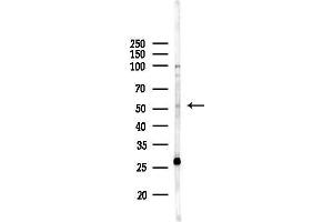 Western blot analysis of lysates from  cells(heat-shock,45 min treatment), using HTR3E Antibody at 1/1000 dilution.