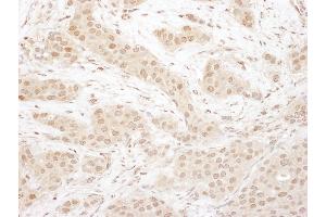 Immunohistochemistry (IHC) image for anti-Cyclin-Dependent Kinase 4 (CDK4) (AA 253-303) antibody (ABIN7455013)